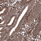 Immunohistochemical staining of human endometrium shows strong nuclear positivity in stromal cells.