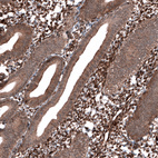 Anti-PTEN Antibody