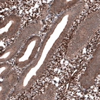 Immunohistochemical staining of human endometrium shows strong nuclear positivity in stromal cells.