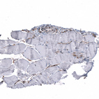 Immunohistochemical staining of human skeletal muscle shows no positivity in myocytes as expected.