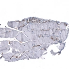Immunohistochemical staining of human skeletal muscle shows no positivity in myocytes as expected.