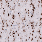 Immunohistochemical staining of human cerebral cortex shows strong positivity in neurons.