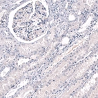 Immunohistochemical staining of human kidney shows no positivity in cells in tubules as expected.