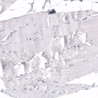 Immunohistochemical staining of human skeletal muscle shows no positivity in myocytes as expected.