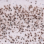 Immunohistochemical staining of mouse cerebral cortex shows strong positivity in neurons.
