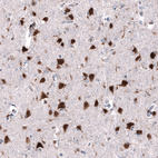 Immunohistochemical staining of human cerebral cortex shows strong positivity in neurons.
