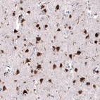 Immunohistochemical staining of human cerebral cortex shows strong positivity in neurons.