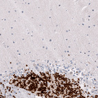 Immunohistochemical staining of human cerebellum shows strong nuclear positivity in cells in granular layer.