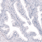Immunohistochemical staining of human prostate shows no positivity in glandular cells as expected.