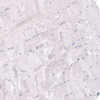 Immunohistochemical staining of human skeletal muscle shows no positivity in myocytes as expected.