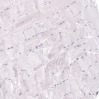 Immunohistochemical staining of human skeletal muscle shows no positivity in myocytes as expected.