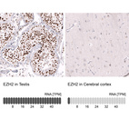 Anti-EZH2 Antibody