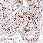 Immunohistochemical staining of human testis shows strong nuclear positivity in cells in seminiferous ducts.