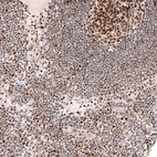 Immunohistochemical staining of human lymph node shows moderate to strong nuclear positivity in lymphoid cells.
