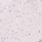 Immunohistochemical staining of human cerebral cortex shows no positivity in neurons as expected.
