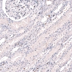 Immunohistochemical staining of human kidney shows mainly absence of positivity in cells in tubules as expected.