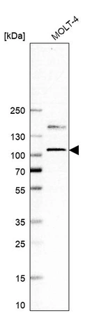 Western blot analysis in human cell line MOLT-4.