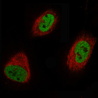 Immunofluorescence staining of U-251 cells using the Anti-EZH2 monoclonal antibody, showing specific staining in nucleoplasm in green. Microtubule probe is visualized in red.