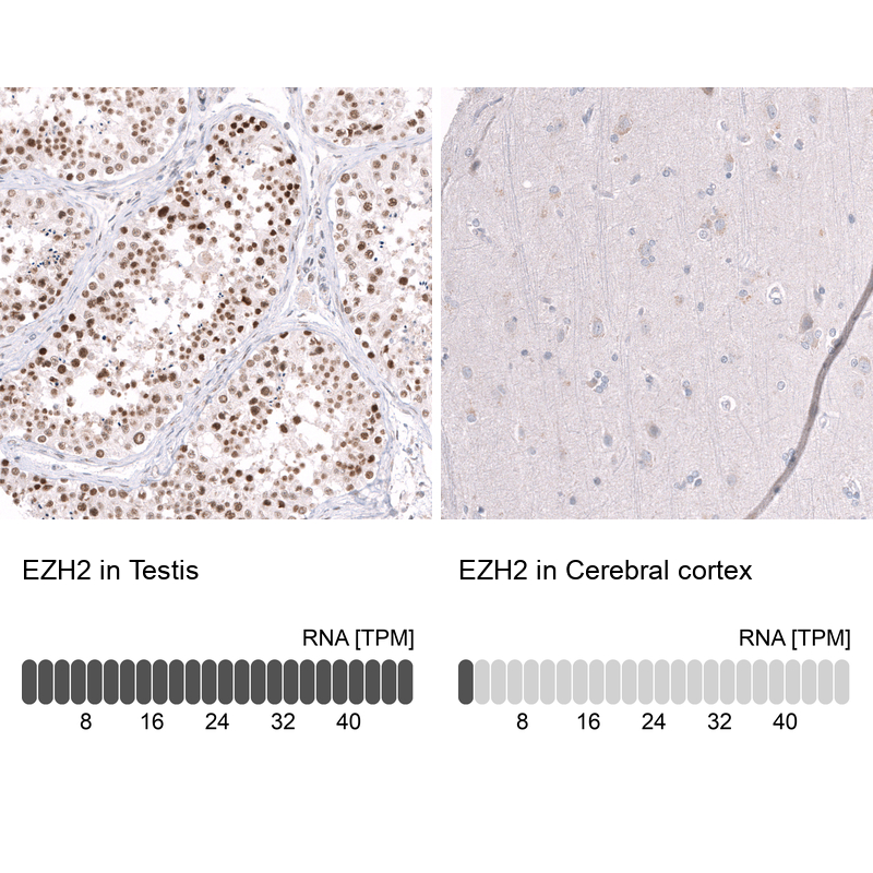 Anti-EZH2 Antibody