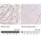 Anti-EZH2 Antibody