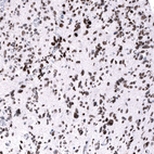 Anti-EZH2 Antibody