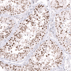 Immunohistochemical staining of human testis shows moderate to strong nuclear positivity in cells in seminiferous ducts.