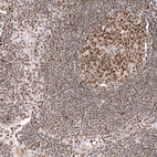 Immunohistochemical staining of human lymph node shows moderate to strong nuclear positivity in lymphoid cells.