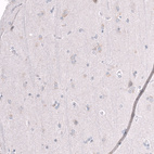 Immunohistochemical staining of human cerebral cortex shows no positivity in neurons as expected.