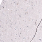 Immunohistochemical staining of human cerebral cortex shows no positivity in neurons as expected.