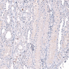 Immunohistochemical staining of human kidney shows no positivity in cells in tubules as expected.