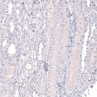 Immunohistochemical staining of human kidney shows no positivity in cells in tubules as expected.
