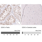 Anti-EZH2 Antibody