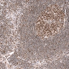 Immunohistochemical staining of human lymph node shows moderate to strong nuclear positivity in lymphoid cells.