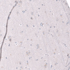 Immunohistochemical staining of human cerebral cortex shows no positivity in neurons as expected.