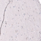 Immunohistochemical staining of human cerebral cortex shows no positivity in neurons as expected.