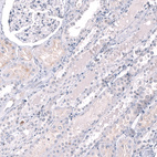 Anti-EZH2 Antibody