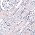 Immunohistochemical staining of human kidney shows no positivity in cells in tubules as expected.