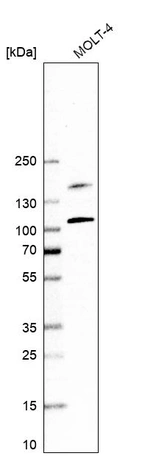 Western blot analysis in human cell line MOLT-4.