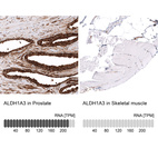 Anti-ALDH1A3 Antibody