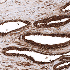 Immunohistochemical staining of human prostate shows strong cytoplasmic positivity in glandular cells.