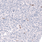 Anti-ALDH1A3 Antibody