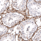 Immunohistochemical staining of human testis shows moderate to strong cytoplasmic positivity in peritubular myoid cells.
