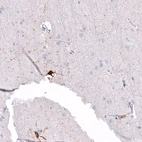 Immunohistochemical staining of human cerebral cortex shows strong cytoplasmic positivity in glial cells.
