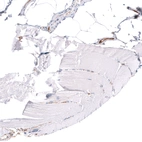 Immunohistochemical staining of human skeletal muscle shows no positivity in myocytes as expected.