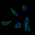 Immunofluorescence staining of PC-3 cells using the Anti-ALDH1A3 monoclonal antibody, showing specific staining in cytosol in green. Nuclear probe is visualized in blue.