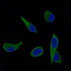 Immunofluorescence staining of PC-3 cells using the Anti-ALDH1A3 monoclonal antibody, showing specific staining in cytosol in green. Nuclear probe is visualized in blue.