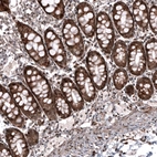 Immunohistochemical staining of human colon shows strong positivity in glandular cells.