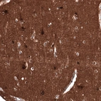 Immunohistochemical staining of human cerebral cortex shows strong nuclear positivity in neurons.