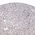 Immunohistochemical staining of human liver shows weak nuclear positivity in hepatocytes.