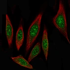 Immunofluorescence staining of PC-3 cells using the Anti-ID1 monoclonal antibody, showing specific staining in nucleoplasm in green. Microtubule probe is visualized in red.